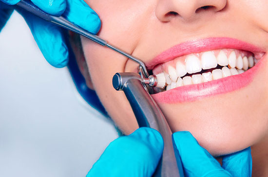 limpieza dental anual
