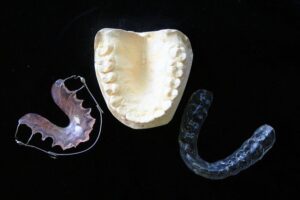 Benefits of dental implants 1