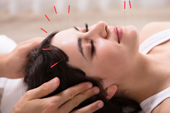 tratar la ansiedad con acupuntura